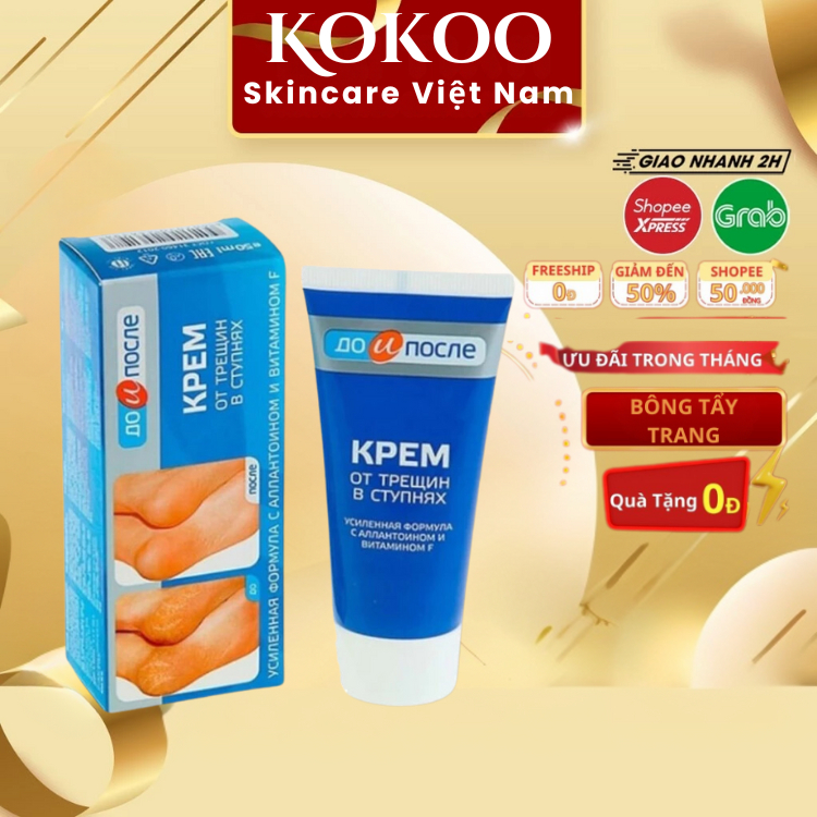 Kem Giảm Nứt Nẻ Gót Chân Kpem của Nga 50ml Giúp tái tạo da gót chân và làm mềm da chân hiệu quả