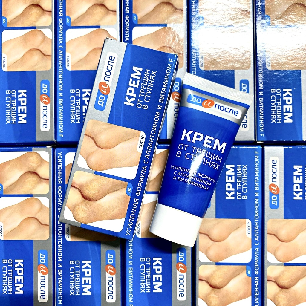 Kem Giảm Nứt Nẻ Gót Chân Kpem của Nga 50ml Giúp tái tạo da gót chân và làm mềm da chân hiệu quả