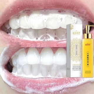 Kem đánh răng làm trắng răng kem đánh răng bạc hà 150g Làm trắng răng loại bỏ vết ố vàng giảm sâu răng Hơi thở thanh mát