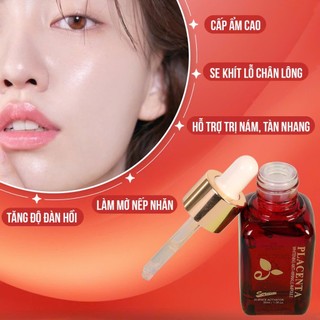 Serum Nhau Thai Cừu Ecosy Placenta