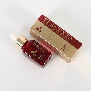 Serum Nhau Thai Cừu Ecosy Placenta