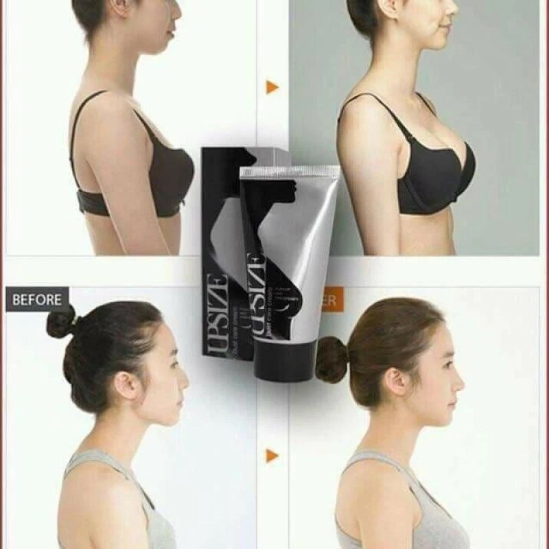 Kem nở ngực upsize tăng vòng 1 hiệu quả chăm sóc ngực hồng nhũ hoa săn chắc vòng 1(có che tên)