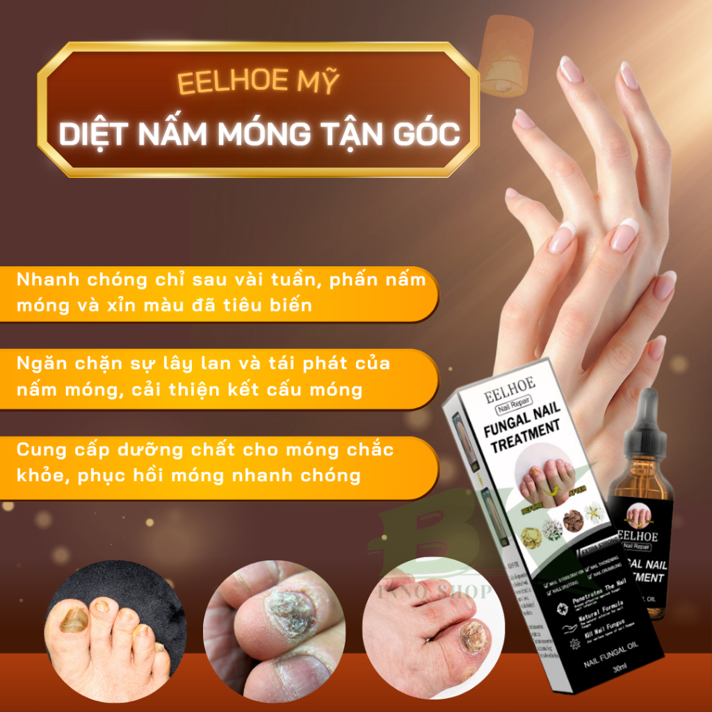 Tinh Chất Diệt Nấm Móng Thảo Dược EELHOE Mỹ Triệt Tiêu Nấm Móng Tay Chân, Dưỡng Móng, Chăm Móng Cứng Chắc Khỏe| BK INNO