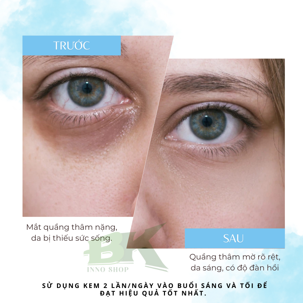 Kem Xóa Tan Quầng Thâm, Tan Bọng Mắt OPENEYES MỸ Hỗ Trợ Trẻ Hóa Vùng Da Mắt, Nâng Cơ Xóa Nhăn, Dưỡng Ẩm Da | BK INNO