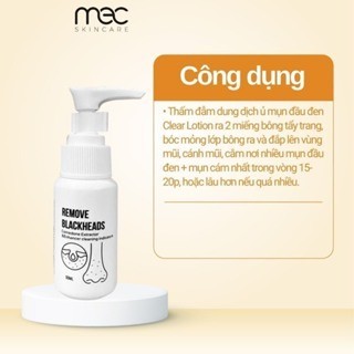 Ủ Mụn Đầu Đen Remove Blackheads
