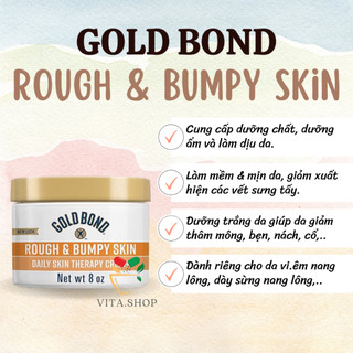  Kem dưỡng da body ngừa viêm lỗ chân lông da sần sùi Gold Bond Ultimate Rough & Bumpy Skin 226gr 