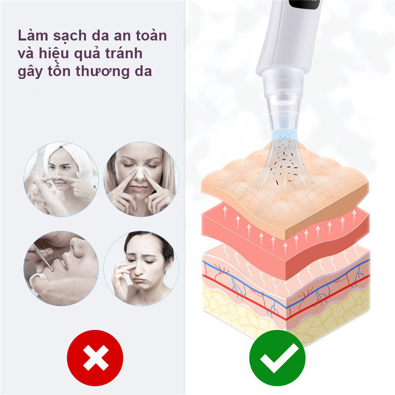Máy hút mụn GOKE làm sạch lỗ chân lông kèm 5 đầu hút chuyên dụng bảo hành 1 năm | BigBuy360 - bigbuy360.vn