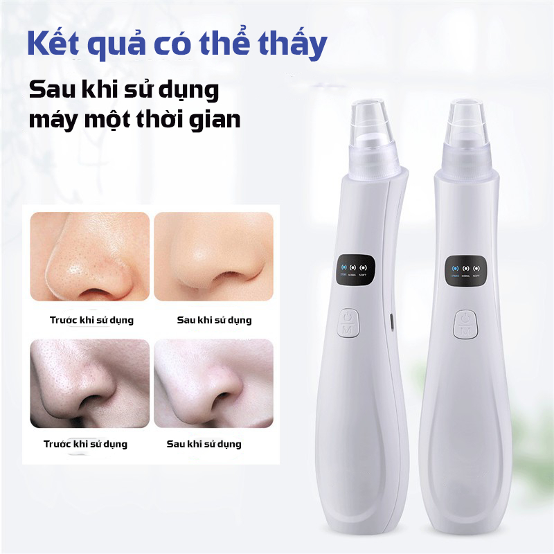 Máy hút mụn GOKE làm sạch lỗ chân lông kèm 5 đầu hút chuyên dụng bảo hành 1 năm | BigBuy360 - bigbuy360.vn