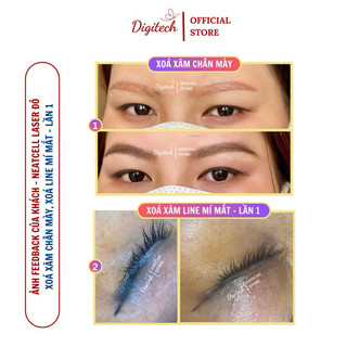 Máy laser Neatcell mini xoá xăm chân mày, line mí mắt & tattoo nghệ thuật – laser đỏ 850nm, 9 cấp độ, tặng kem Laser