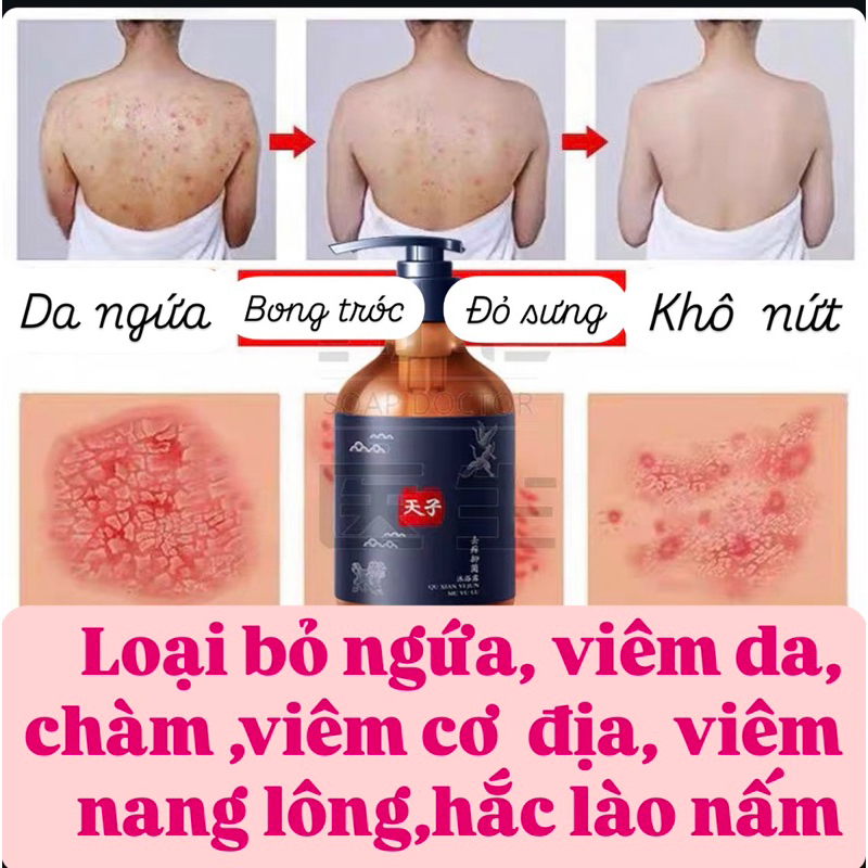 Sữa Tắm Giảm Ngứa,Sưng Tấy Đỏ Kháng Khuẩn,Giảm Viêm Nang Lông ,Vảy Nến, Chàm Thảo Mộc 250ML