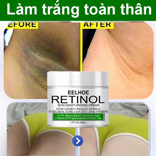 kem giảm thâm nách kem làm trắng nách Kem Làm Trắng Da Nách Mông Làm Trắng Da Dưỡng Giảm Thâm Đầu Gối Mông