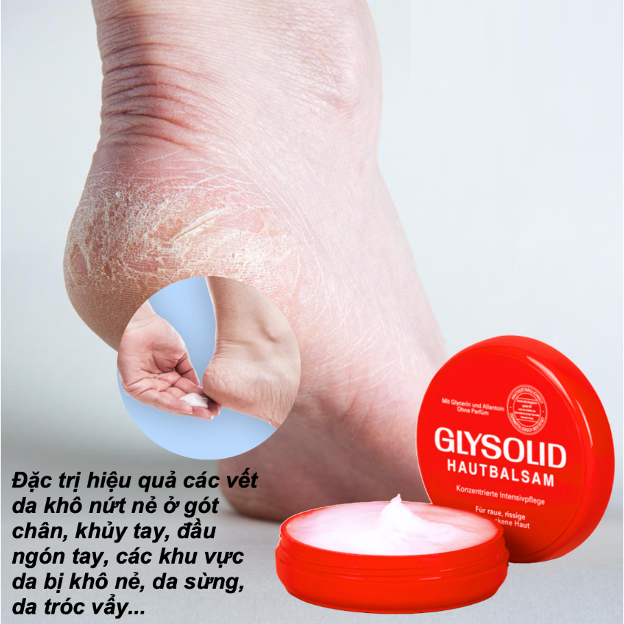 Kem nẻ Glysolid, kem dưỡng ẩm Glysolid Hautbalsam Đức dưỡng mềm da loại bỏ khô ráp nứt nẻ gót chân, tay 100 ml