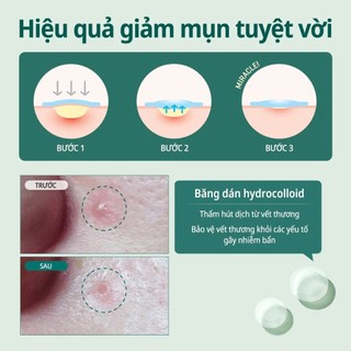Miếng Dán Lột Mụn Some By Mi Clear Spot Patch 18 Miếng