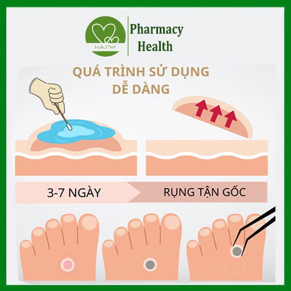 Dung Dịch Acid trichloracetic 80% hỗ trợ  ̣ Sùi Mào Gà, Mụn Cơm, Mụn Cóc, Nhanh Chóng, An Toàn, Hiệu Qủa