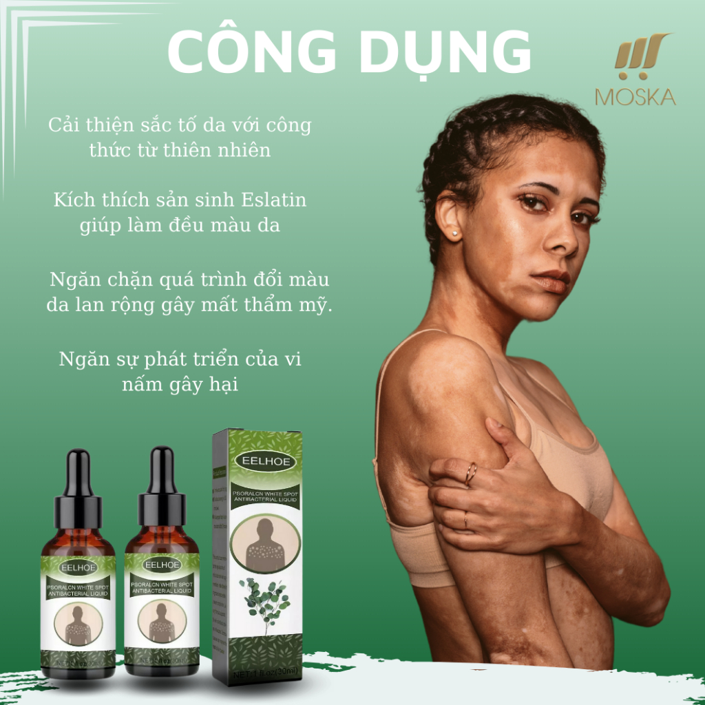 Tinh Chất Bôi Lang Ben Bạch Biến Hắc Lào EELHOE 30ml, Serum Xoá Tan Bạch Biến, Vảy Phấn Trắng, Giúp Da Sạch Khoẻ Đều Màu