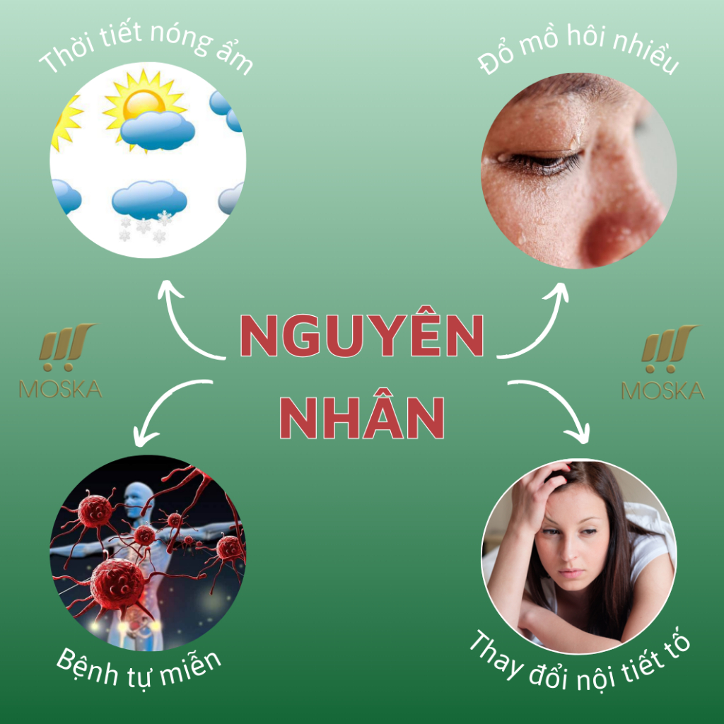 Tinh Chất Bôi Lang Ben Bạch Biến Hắc Lào EELHOE 30ml, Serum Xoá Tan Bạch Biến, Vảy Phấn Trắng, Giúp Da Sạch Khoẻ Đều Màu