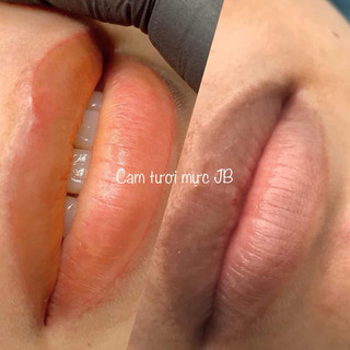 Mực siêu phá thâm cam trung tính JB master 10ml
