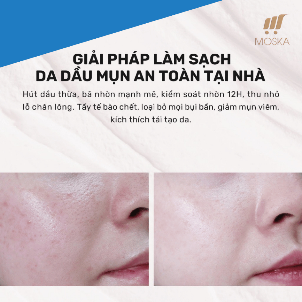 Mặt nạ AHA Nga đất sét xanh Compliment giảm mụn, se khít chân lông 80ml (VẠCH XANH LÁ)