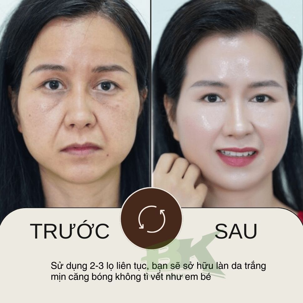 Kem Xóa Nếp Nhăn, Mờ Nám, Tàn Nhang QINGLING 50Gr Bổ Sung Collagen, Hỗ Trợ Trẻ Hóa Làn Da, Dưỡng Da Trắng Mịn| BK INNO