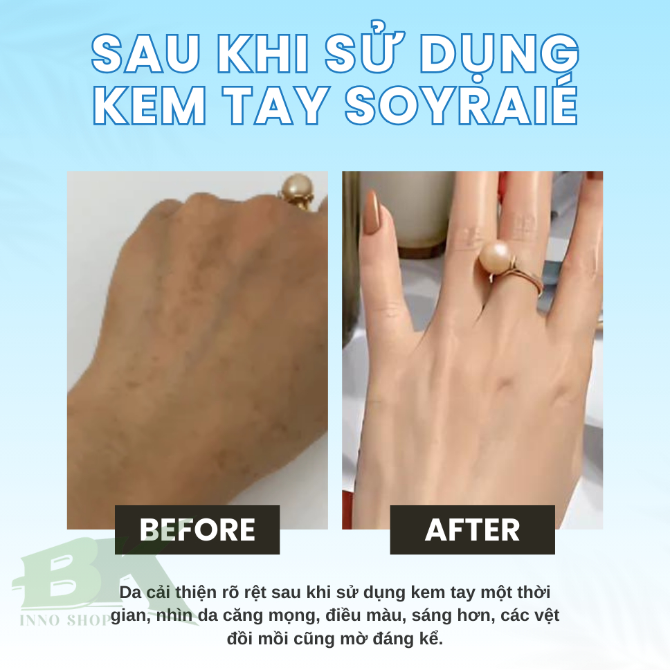 Kem Dưỡng Da Tay SOYRAIÉ 100g Cấp Ẩm Chuyên Sâu, Giúp Da Tay Mềm Mịn, Trắng Sáng Tự Nhiên, Không Vết Thâm Sạm | BK INNO