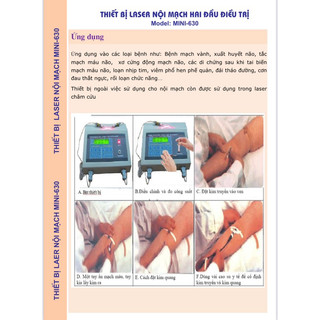 Máy điều trị lazer nội mạch
