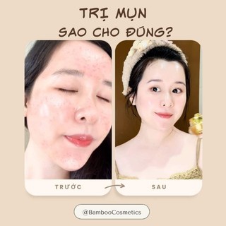 🌟Kem Mụn Acne Whitening Cream Bambool🌟giúp mờ thâm, trắng da