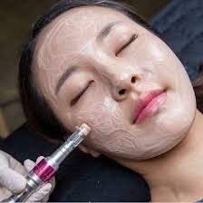 Cấy Phấn Meso White Spa . Cấy Trắng Meso White