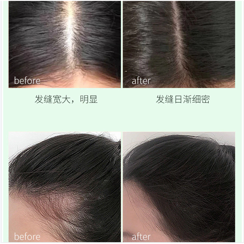 Tinh Chất Mọc Tóc Nhân Sâm YAOPIN - Xịt Mọc Tóc YAOPIN Kích Mọc Tóc, Giảm Rụng Tóc, Hói Đầu, Tóc Chắc Khỏe, Đen Óng