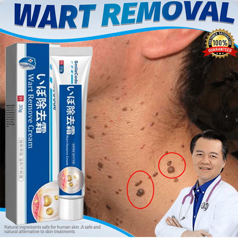 kem xoá mụn cóc 20g Loại bỏ mụn cóc, mụn thịt , loại bỏ mụn cóc thông thường ,mụn đá , mụn cơm ,mụn cóc dạng sợi