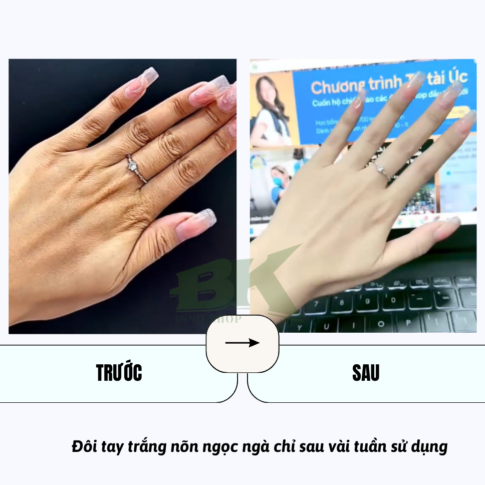 Kem Xóa Nhăn, Giảm Nám Da Tay HANJILIAN Nhật Bản, Dưỡng Da Tay Mềm Mịn, Trắng Sáng, Ngăn Ngừa Nám, Đồi Mồi | BK INNO