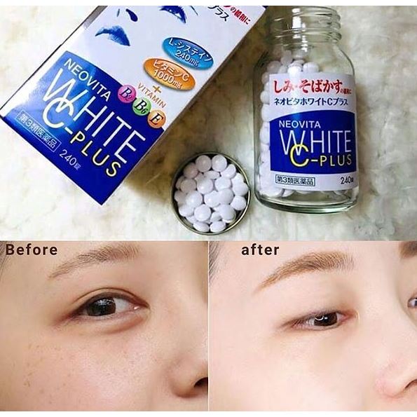 Viên uống Trắng Da Neovita White C-Plus Nhật Bản hỗ trợ làm giảm tàn nhang nám đồi mồi dưỡng trắng da