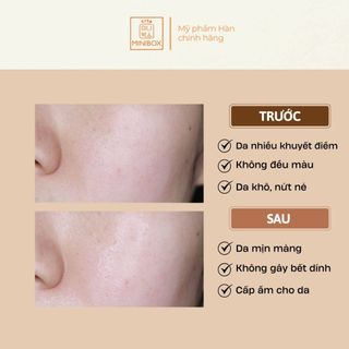 (BILL HÀN) Tinh Chất Dưỡng Da IT'SSKIN Power 10 Formula Effector 30ml