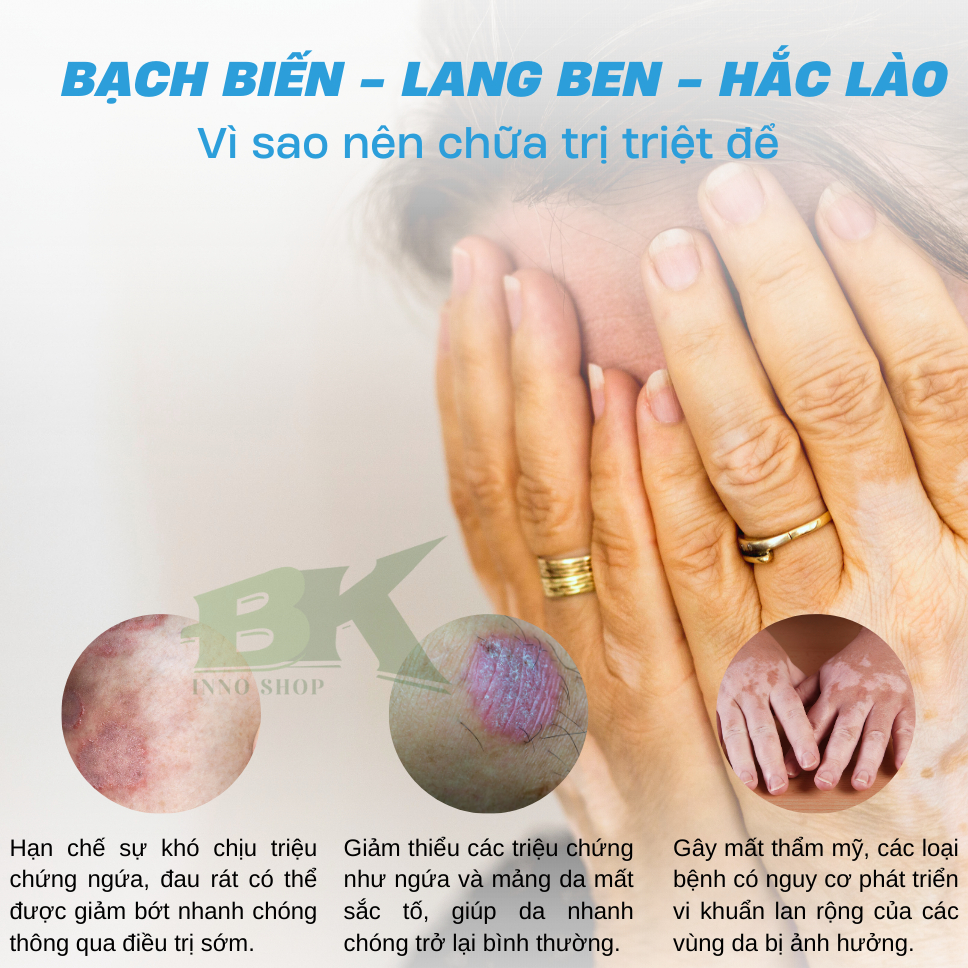 Xịt Bạch Biến Thảo Dược Cổ Truyền Nhật Bản SENKO Giảm Đốm Trắng Bạch Biến, Hắc Lào, Lang Ben, Viêm Da Cơ Địa | BK INNO