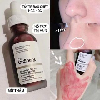 The Ordinary AHA 30% + BHA 2% Peeling Solution
