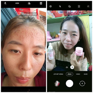 Kem Dưỡng Trắng Da Mặt 2 Tầng Myô hỗ trợ giảm [Mụn-Thâm-Nám] có chống nắng SPF 45+