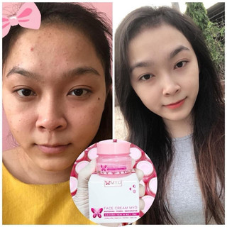 Kem Dưỡng Trắng Da Mặt 2 Tầng Myô hỗ trợ giảm [Mụn-Thâm-Nám] có chống nắng SPF 45+