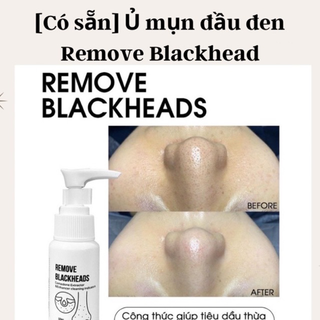 ủ mụn đầu đen remove blackhead
