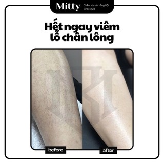 𝐌𝐢𝐭𝐭𝐲 𝐁𝐞𝐚𝐮𝐭𝐞 - Bột Đậu Đỏ Nguyên Chất đắp mặt nạ ủ trắng da giảm mụn lưng face&body