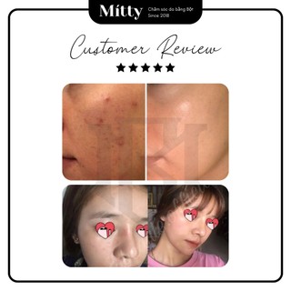 𝐁𝐎̣̂𝐓 𝐊𝐇𝐎̂̃ 𝐐𝐔𝐀 𝐑𝐔̛̀𝐍𝐆 - bột khổ qua rừng giảm mụn sáng da, bột thiên nhiên đắp mặt Mitty Beaute