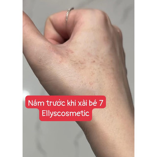 Kem hỗ trợ nám phục hồi da E.Cosmetic