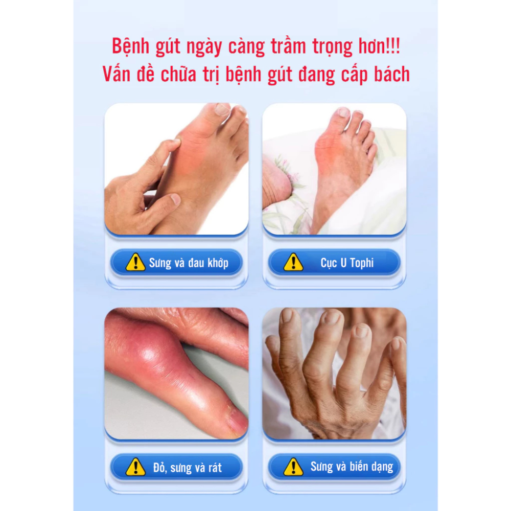 Gel lạnh thoa gout, giảm đau, cải thiện tình trạng đau nhức khớp gối, khớp ngón tay, chân hiệu quả