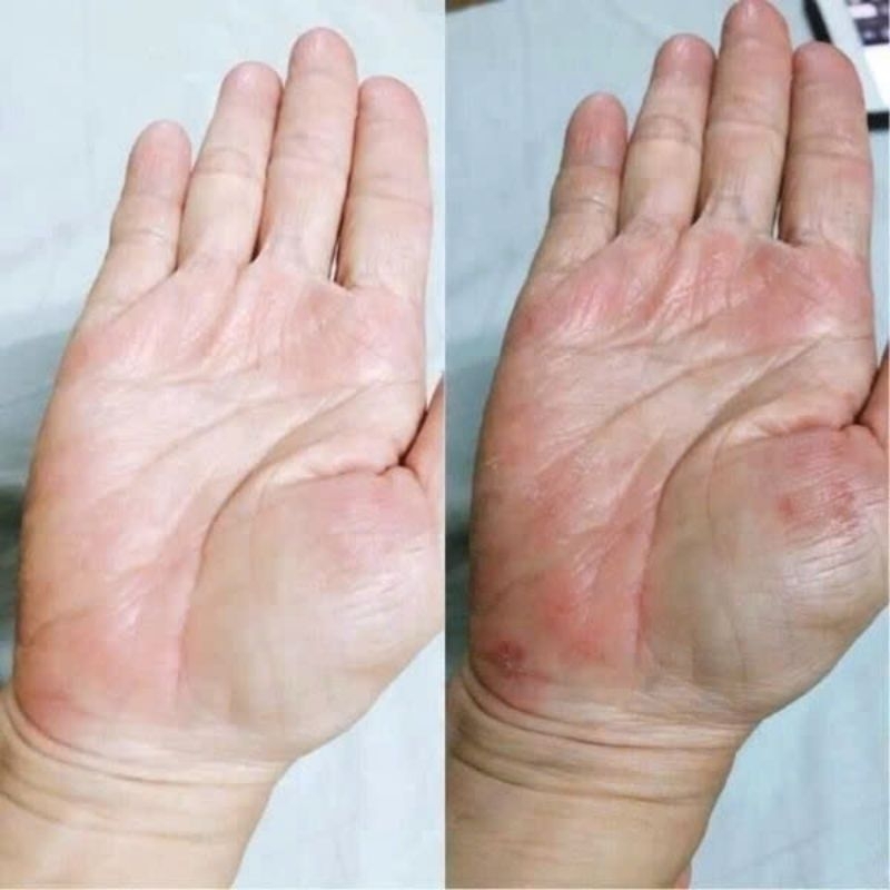 KEM BÔI VẨY NẾN THÁI LAN