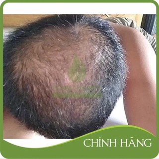 Dung dịch mọc râu tóc Tugain 60ml