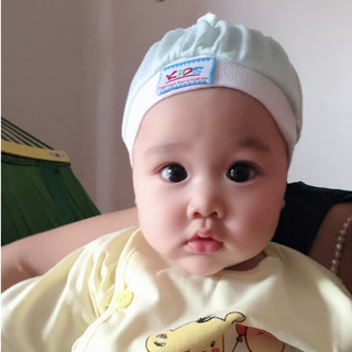mũ che thóp hở cho bé sơ sinh