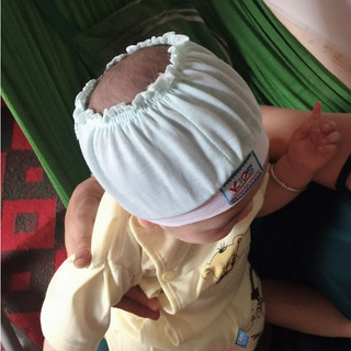 mũ che thóp hở cho bé sơ sinh