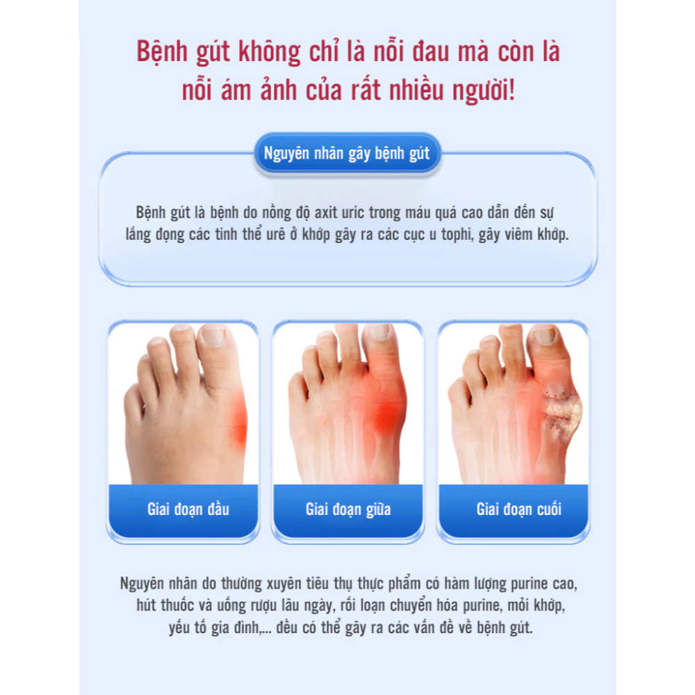 Gel Lạnh Bôi Gout TYPE COLD SKIN – Gel COLD SKIN Giảm Đau Gout, Dịu Nhức Khớp, Mang Lại Sự Linh Hoạt Cho Gối, Ngón Tay