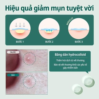 Miếng Dán Mụn Some By Mi Clear Spot Patch