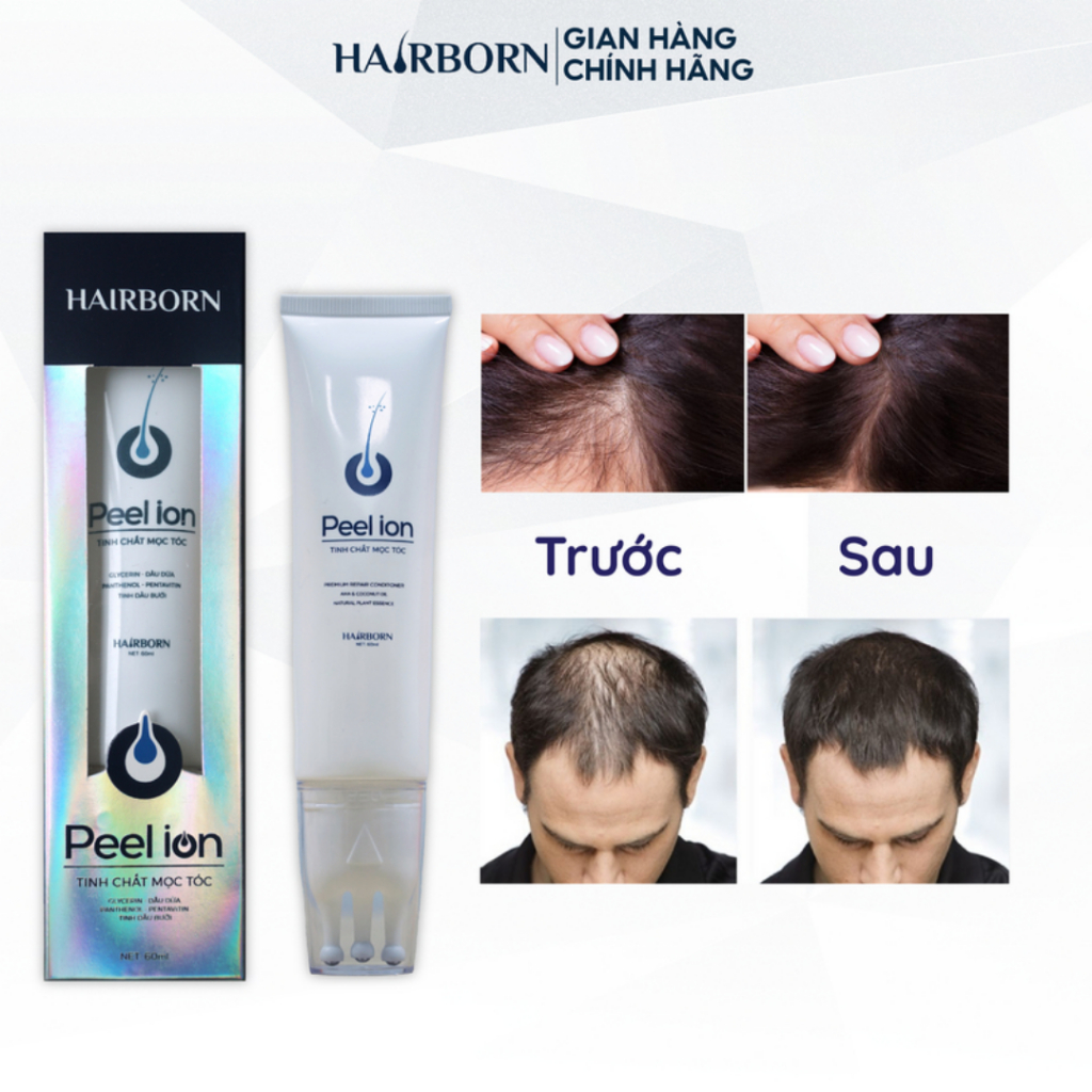 Lăn kích mọc tóc Hairborn - Lăn 5in1 giúp mọc tóc nhanh Hairborn - kích mọc tóc giảm gầu và giảm rụng tóc - QUINN BEAUTY