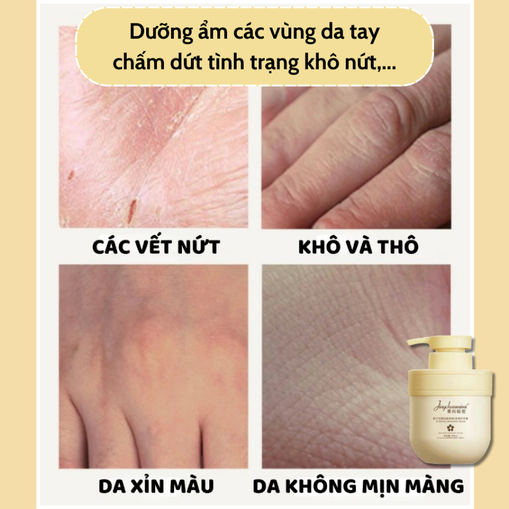 Kem dưỡng da JINGCHUNMIMI - Giảm khô nứt da với kem dưỡng ẫm Jingchunmimi, giúp da mịn màng, giảm khô nứt - QUINN BEAUTY