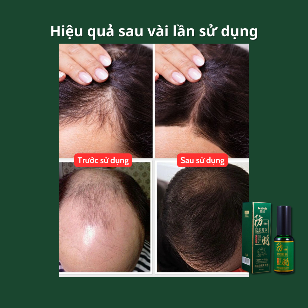 Xịt kích mọc tóc Seefair - Kích thích mọc tóc Seefair, giúp tóc mượt mà, chắc khỏe ngăn ngừa rụng tóc - QUINN BEAUTY
